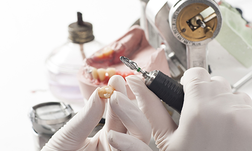 当院では歯ぐきにも配慮し、機能性と清掃性を兼ね備えた長持ちする美しい歯をご提供します