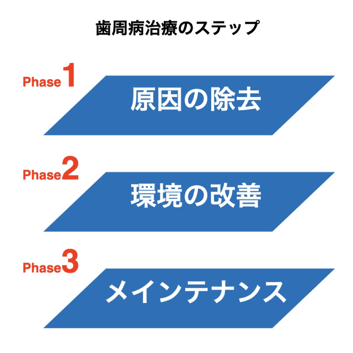 歯周病治療のステップ